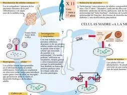 Logran células madre «personalizadas» contra diez enfermedades incurables