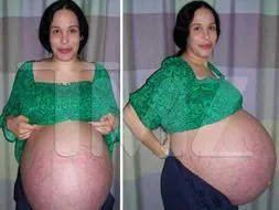Las imágenes de la madre de los octillizos antes de dar a luz