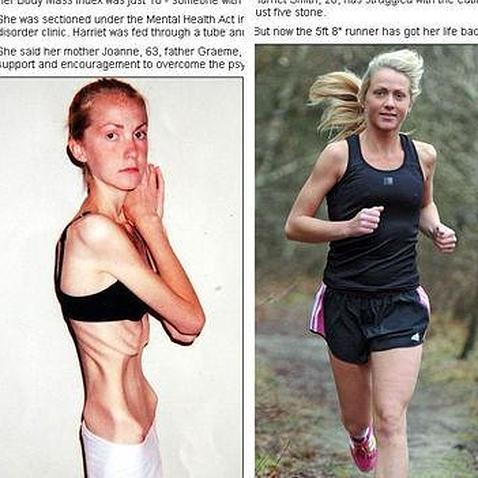 Harriet Smith, un ejemplo de superación de la anorexia
