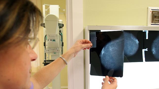 La radioterapia en altas dosis, la última esperanza en el cáncer de mama