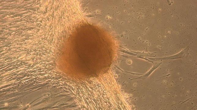 Crean «minihígados» en el laboratorio a partir de células madre de la placenta