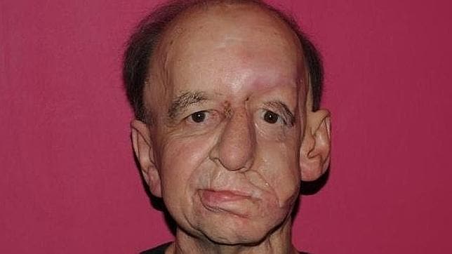Un británico recupera su rostro gracias a una impresora 3D