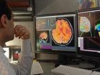 Diagnostican el Alzheimer con ayuda de la tecnología espacial
