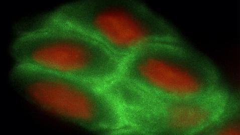 Por vez primera regeneran en vivo un córnea humana con el uso de células madre adultas