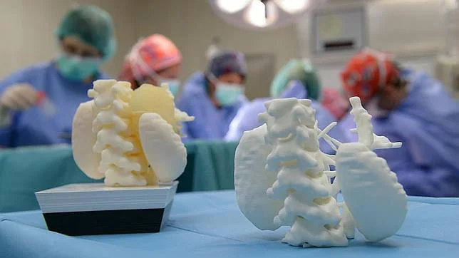 Extirpan un tumor casi inoperable gracias a la ayuda de una maqueta en 3D