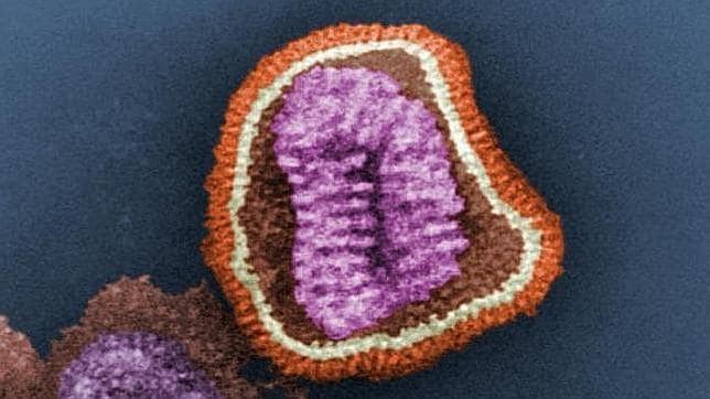 Los diez virus más letales de la Historia