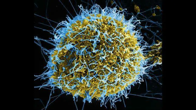 ¿Cuál es el origen del virus ébola?