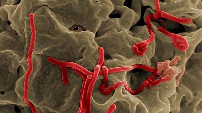 Medidas para evitar el contagio del virus ébola en España