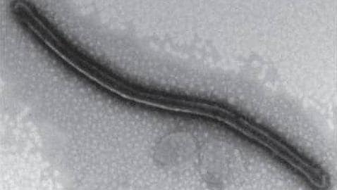 El virus similar al ébola que fue descubierto en Asturias