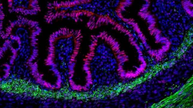 Fabrican un intestino humano con células madre que funciona en ratones