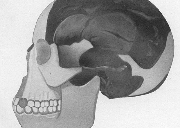El cráneo de Piltdown fue construido con trozos de huesos de humanos y primates para simular ser un fósil del «eslabón perdido»