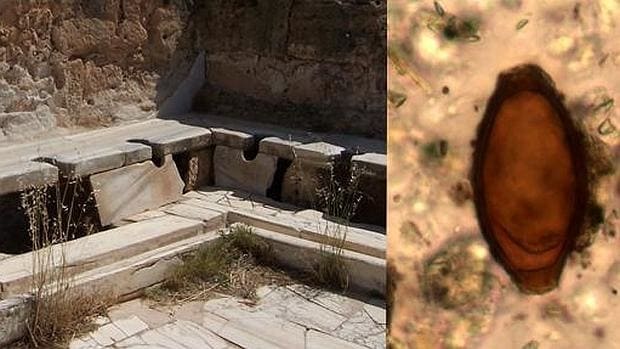 Aseos públicos romanos en Leptis Magna, Libia, y huevo de triquina