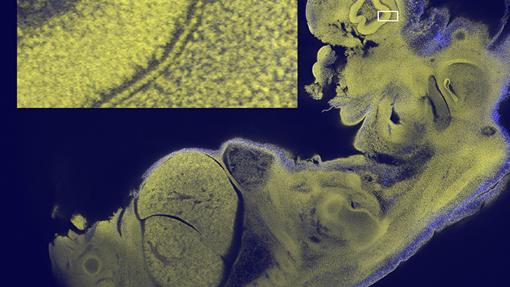 Imagen del embrión de un ratón. En el rectángulo, ampliado a la izquierda, detalle del ojo