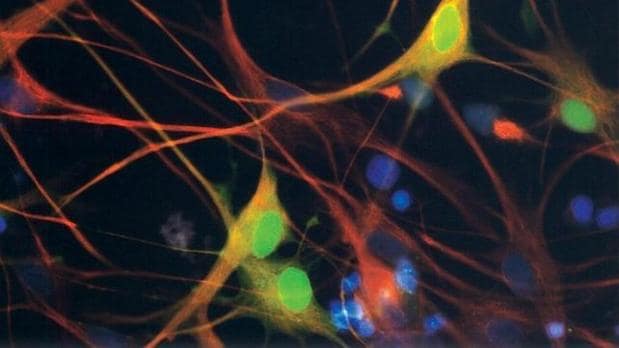 Varias neuronas teñidas por medio de técnicas de fluorescencia