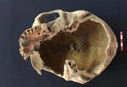Supuesto cráneo de Arnaldo de Torroja. Se ha podido extraer ADN de su dentadura