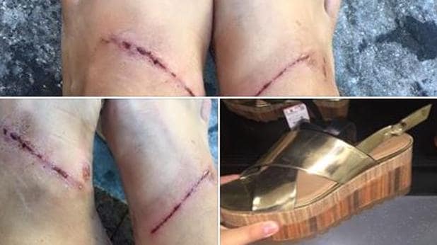 Elsa Sarmiento ha denunciado a través de Facebook el daño que le han provocado unas sandalias de Zara