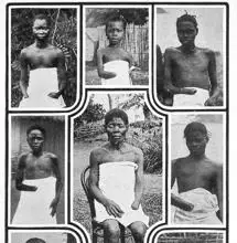Capitalismo, colonialismo y genocidio. Un caso en Africa colonial: los herero y namaqua. [HistoriaC] Brazos-mutilados-belgica-kMb--220x220@abc