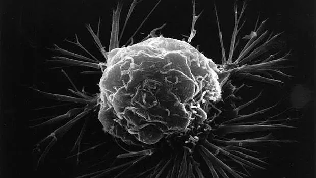 Célula del cáncer de mama