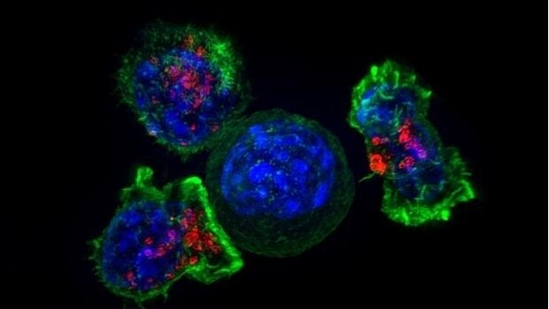 Células del sistema inmune rodean una célula tumoral