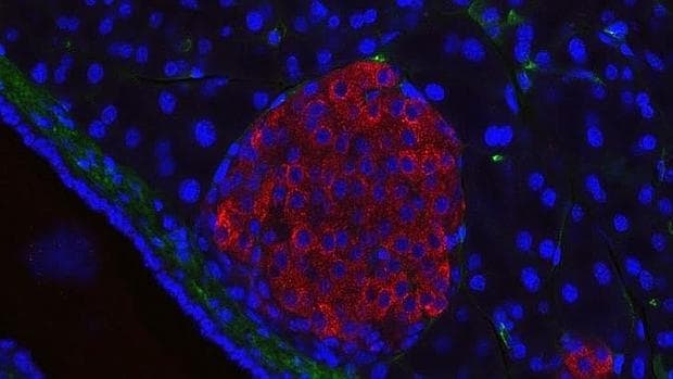 Islotes pancreáticos con células beta productoras de insulina