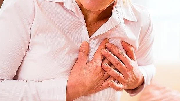 El 45% de los infartos de miocardio son asintomáticos