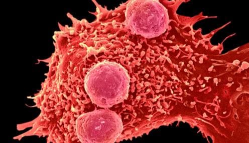 La técnica llamada «corta-pega» genético podría hacer que las células cancerosas se autorregulan y detengan su propio crecimiento sin necesitar tratamiento alguno