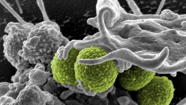 Interacción entre el sistema inmune y la bacteria 'Staphylococcus aureus' (en verde)