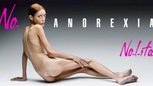 nolita-anorexia-khwG--510x287@abc.jpg