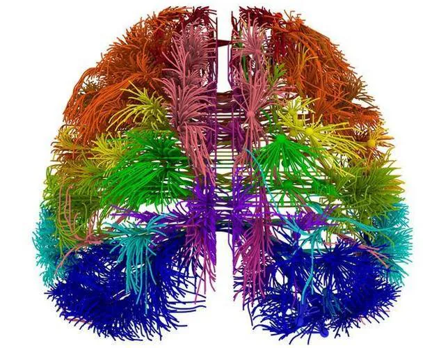 Proyecto Brain sobre el mapa del cerebro