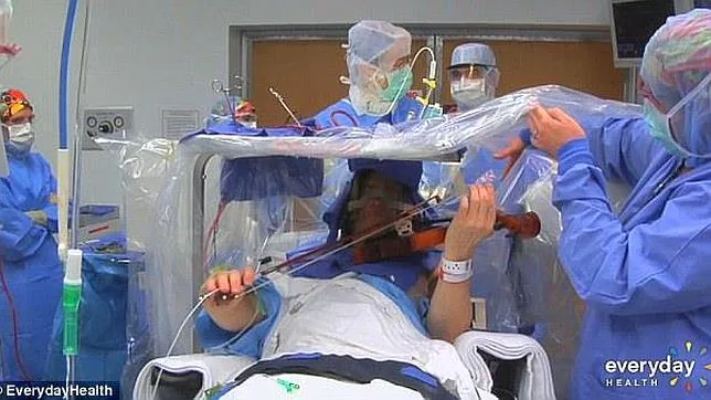 Un músico toca el violín mientras le hacen una operación en el cerebro