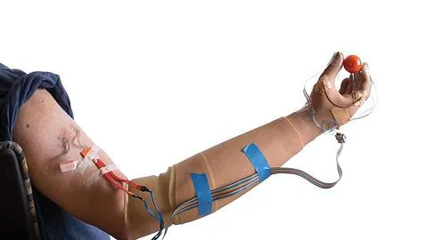 Un brazo biónico permite a un amputado volver a su vida normal