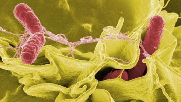 MicrofotografÃ­a coloreada de Salmonella typhimurium. El microbioma es el conjunto de los microorganismos que viven en el intestino y tiene un importante papel en la salud