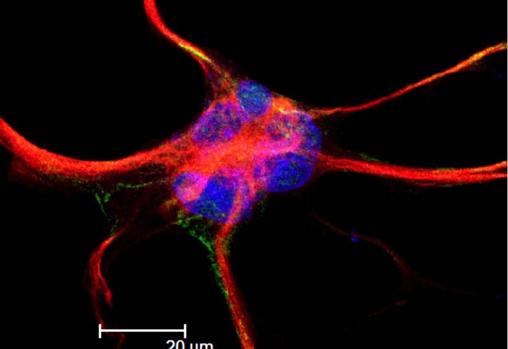 Un astrocito, una cÃ©lula de apoyo de las neuronas, teÃ±ido con marcadores fluorescentes. Se han encontrado bacterias dentro de estas cÃ©lulas