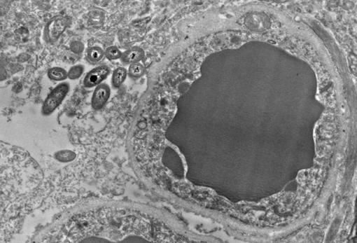 Fotografía de un astrocito, una célula de soporte de las neuronas. La mancha gris del centro es un capilar, a la izquierda, varias bacterias