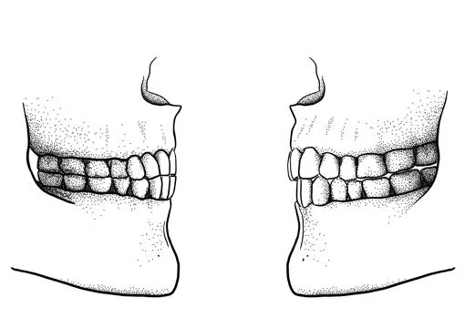 Diferencia entre la mordida del PaleolÃ­tico (izquierda), con los dientes superiores e inferiores alineados, y la moderna (derecha), con los dientes superiores adelantados