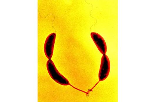 FotografÃ­a de Â«Caulobacter crescentusÂ», cuyo genoma ha sido usado como base en esta investigaciÃ³n