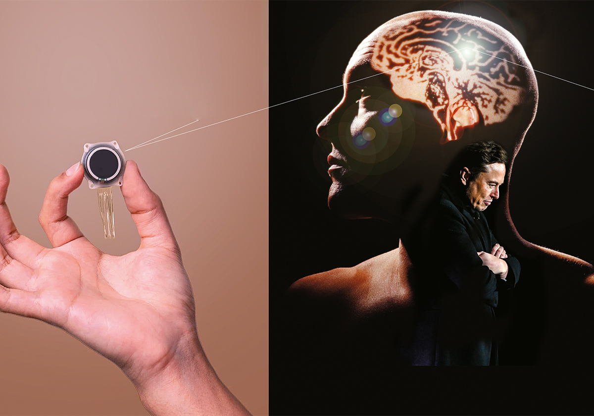 Elon Musk quiere insertarte este microprocesador en el cerebro