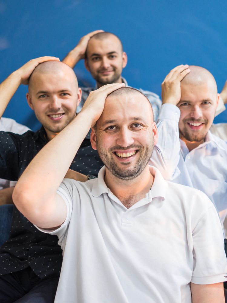 Logran revertir la calvicie con células madre