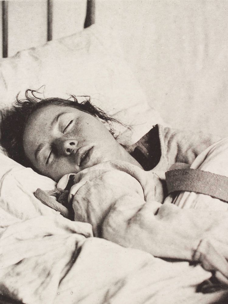 Histeria: cuando el útero viajaba por el cuerpo y volvía 'locas' a las mujeres